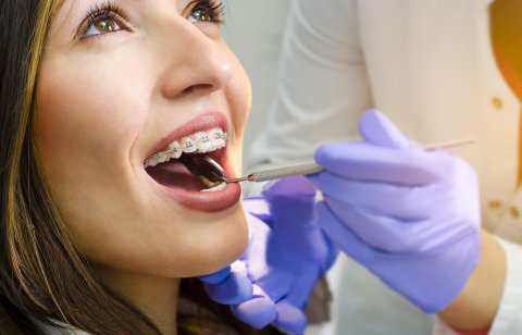 Ortodoncie pro dospělé; Ortodoncie pro dospělé vám pomůže s řešením estetických a funkčních nedostatků vašich zubů. Naše ortodontická ambulance v Brně nabízí dospělým klientům nenápadné fixní aparáty, příjemné prostředí, osobní přístup.